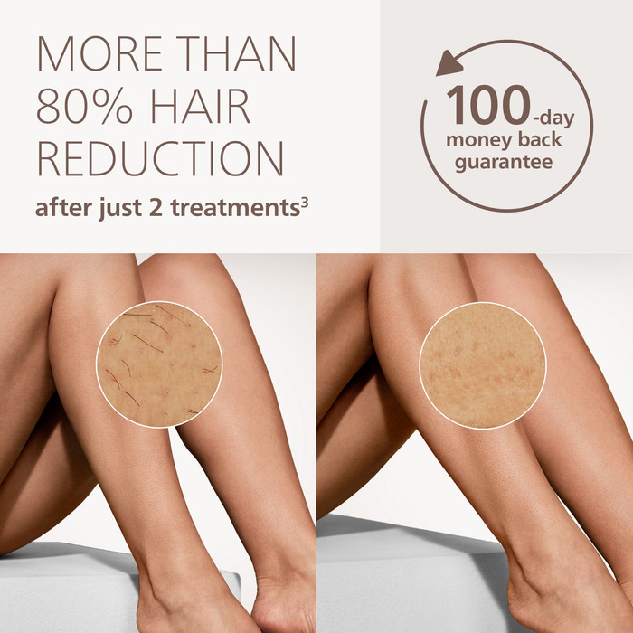 Philips Lumea IPL Series 9000 BRI983/00 visueller lieferant