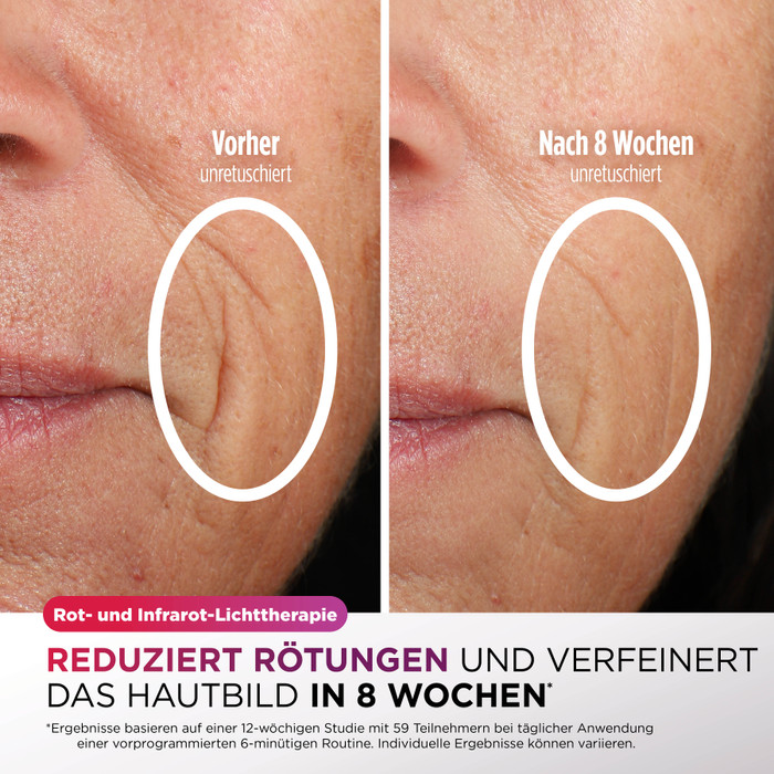 Shark CryoGlow FW312EUPL visueller lieferant