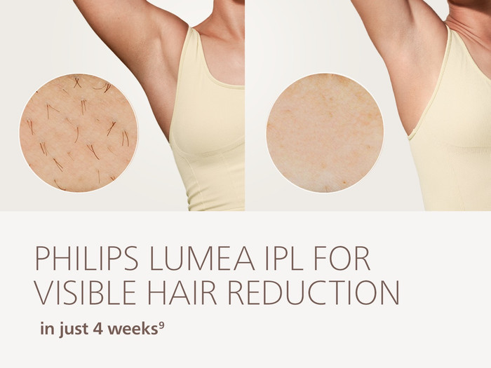 Philips Lumea IPL 8000 Series BRI934/00 visueller lieferant