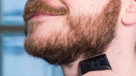 Type of beard growth